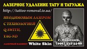 Лазерное удаление tattoo и перманентного tattooажа Николаев